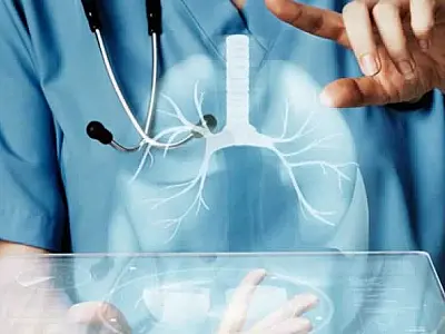 Cubatão intensifica busca ativa visando ao Mês de Combate à Tuberculose