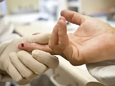Casos de sífilis e de HIV/aids aumentam entre homens jovens