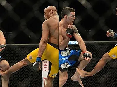 Anderson Silva diz que ainda sente dor na perna quebrada há mais de oito anos