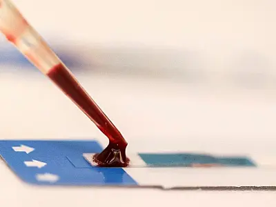 Metrô de São Paulo faz ação de combate ao HIV