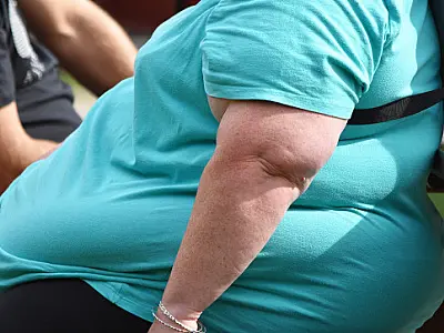 Pessoas obesas têm menor gasto calórico durante o dia, diz estudo