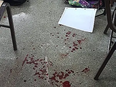 Ataque com faca deixa dois alunos feridos em colégio de São Paulo