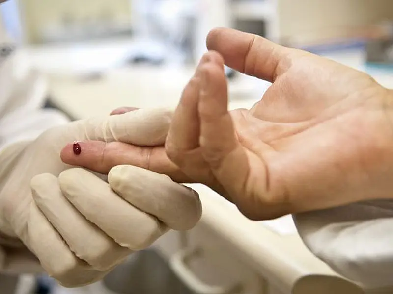Pandemia de Aids pode acabar até 2030, diz Unaids