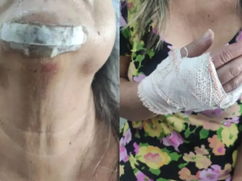 Mulher cai em ponte de São Vicente e fica ferida