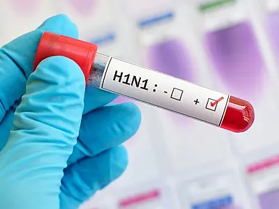 Casos de H1N1 crescem entre adultos; diagnósticos de covid-19 caem