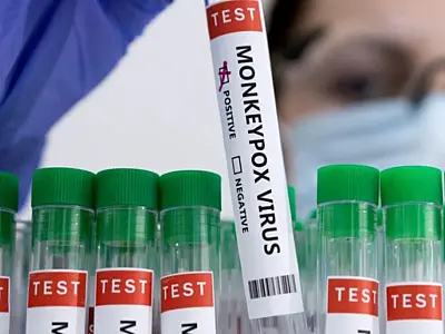 Brasil supera marca de mil casos de mpox em 2024