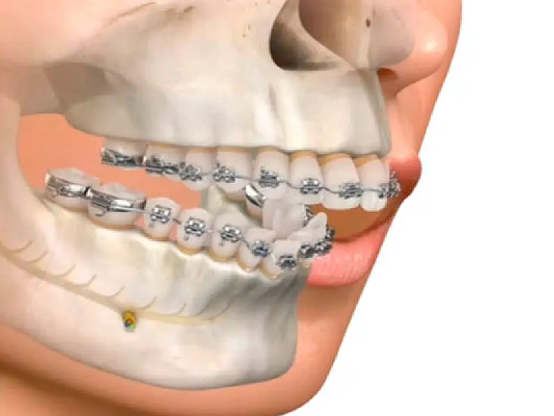 Praia Grande amplia a oferta de cirurgia bucomaxilofacial na rede municipal