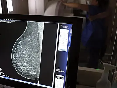 Outubro Rosa: Secretaria da Saúde de São Vicente promove ações de prevenção ao câncer de mama