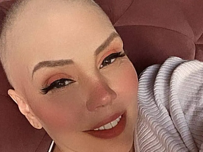 Cantora Simony retoma tratamento contra câncer de intestino grosso