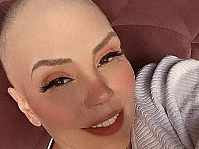 Cantora Simony retoma tratamento contra câncer de intestino grosso