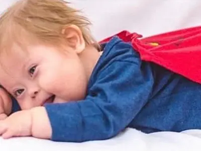 Morre Super Chico, menino com Down que superou a Covid por duas vezes