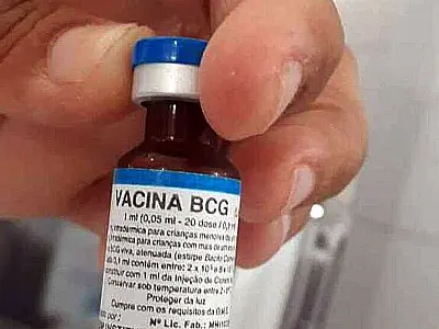 Pacientes reumáticos têm mais risco de desenvolver tuberculose