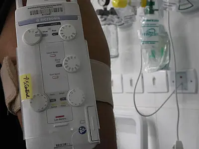 PG possui serviço de colocação de marca-passo cardíaco em toda a rede de Urgência e Emergência