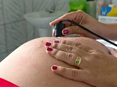 Teste para HTLV passa a ser indicado para gestantes durante pré-natal
