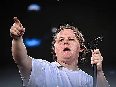 Lewis Capaldi anuncia pausa na carreira para tratar síndrome de Tourette