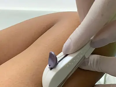 São Vicente promove mutirão com coleta de papanicolau, vacinação contra HPV e inserção de Implanon
