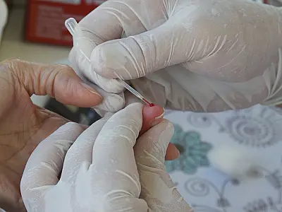 Mais de 100 testes de hepatite C são realizados no Quebra-Mar em Santos