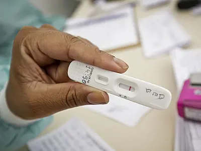 Positividade de testes de covid-19 subiu de 4% para 13%, detalha UFRJ