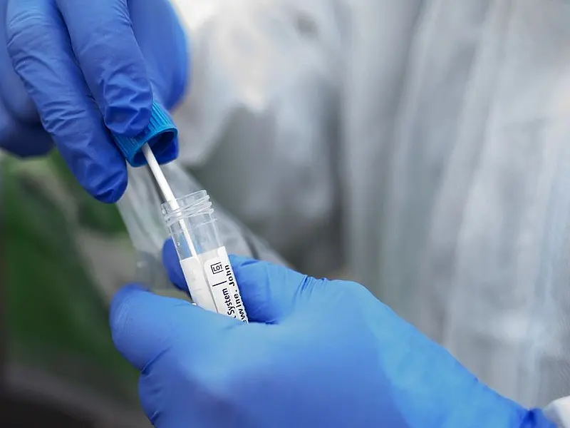 Dois anos após primeiro caso de Covid no Brasil, infectologista alerta para variante BA.2