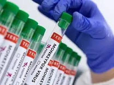 Governo paulista reforça vigilância e monitoramento da mpox no estado