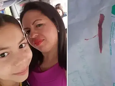 Ferrão venenoso de peixe com 7 cm perfura pé de criança em praia de SP