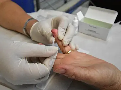 PG oferece testes rápidos e exames de tuberculose no Terminal Tatico neste sábado
