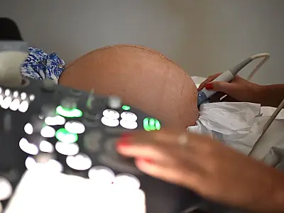 Planos de saúde lideram reclamações em nove dos últimos 10 anos