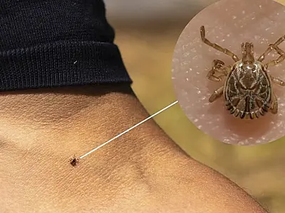 Saiba como se proteger contra a febre maculosa nas férias