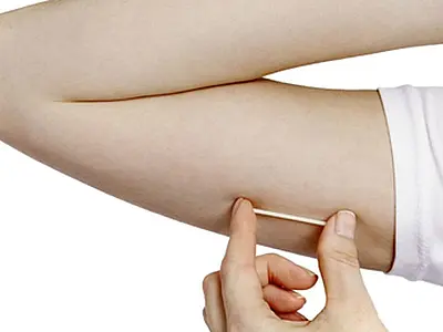 'Mutirão do Contraceptivo Implanon' contempla mais de 50 adolescentes