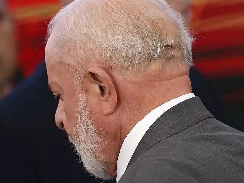 Médico de Lula descarta sequela e diz que função cerebral está intacta
