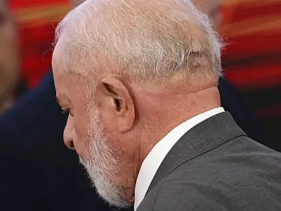 Médico de Lula descarta sequela e diz que função cerebral está intacta