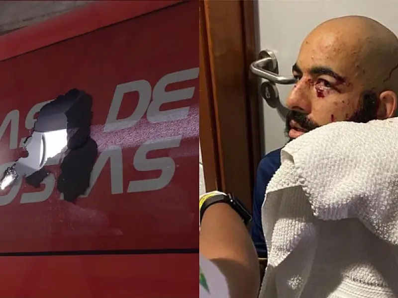 Ônibus do Bahia sofre ataque a bomba antes de jogo e atletas ficam feridos