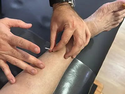 A importância de tratamentos complementares na luta contra a fibromialgia