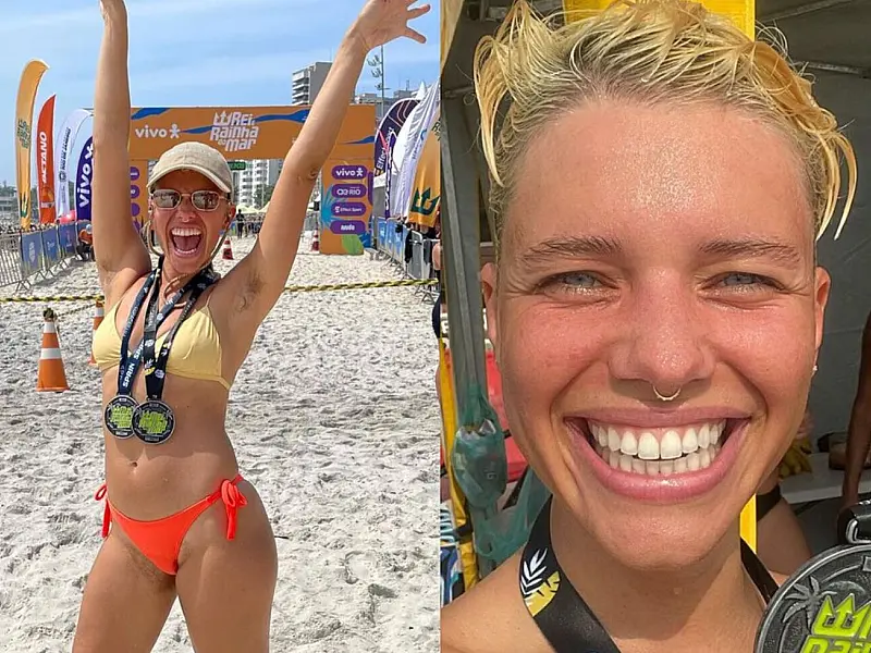 Bruna Linzmeyer é atacada na web por não se depilar