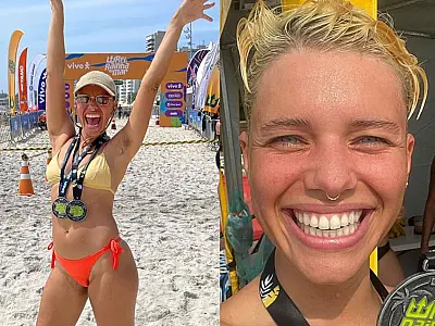 Bruna Linzmeyer é atacada na web por não se depilar