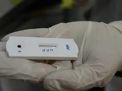 Saúde orienta farmácias sobre testes para HIV, sífilis e hepatites
