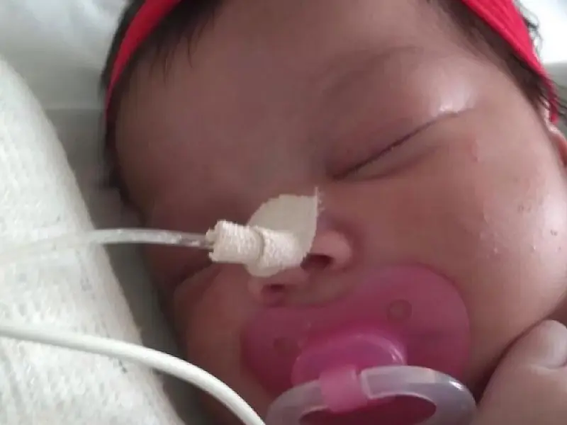 Bebê de Guarujá espera por cirurgia no coração há quase dois meses e família revela aflição