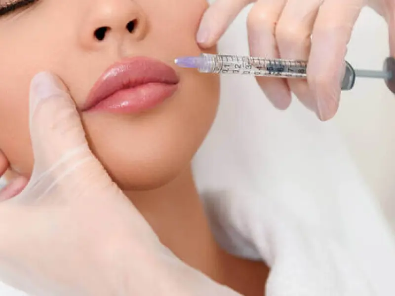 Especialista explica quais são os riscos e benefícios do preenchimento labial