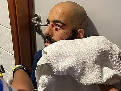 Goleiro atingido por estilhaços irá passar por procedimento a laser