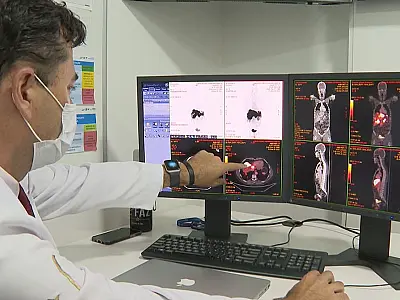 Inca defende cuidados mais justos para controle do câncer