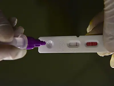 PF investiga fraudes em testes de covid-19 em Santa Catarina
