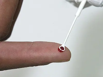 PrEP: tratamento preventivo é alternativa no combate ao HIV no Brasil