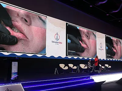Casos de complicações estéticas reacendem debate sobre preenchimentos faciais e corporais no Brasil