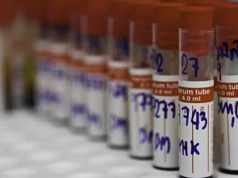 Mongaguá reduz espera de exames de sangue de 90 para 10 dias