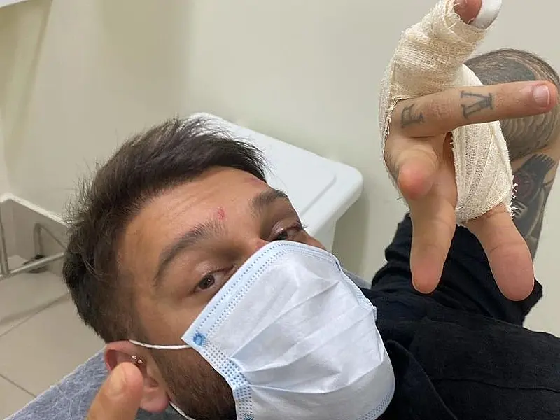 Lucas Lucco preocupa fãs após aparecer com o rosto machucado