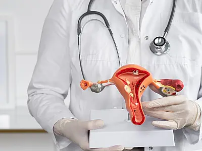 Diagnóstico de endometriose ainda é um desafio para mulheres