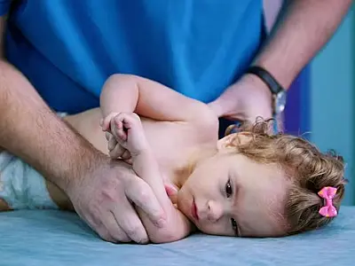 8 mil bebês são diagnosticados com paralisia cerebral por ano no Brasil