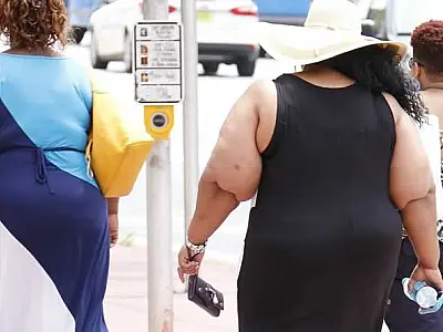 Um a cada três brasileiros vive com obesidade, mostra relatório global