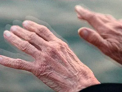 Tratamento para depressão tem se mostrado eficaz contra Parkinson