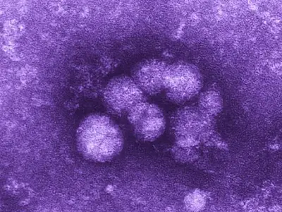 Hepatites virais matam 3,5 mil por dia no mundo, alerta OMS